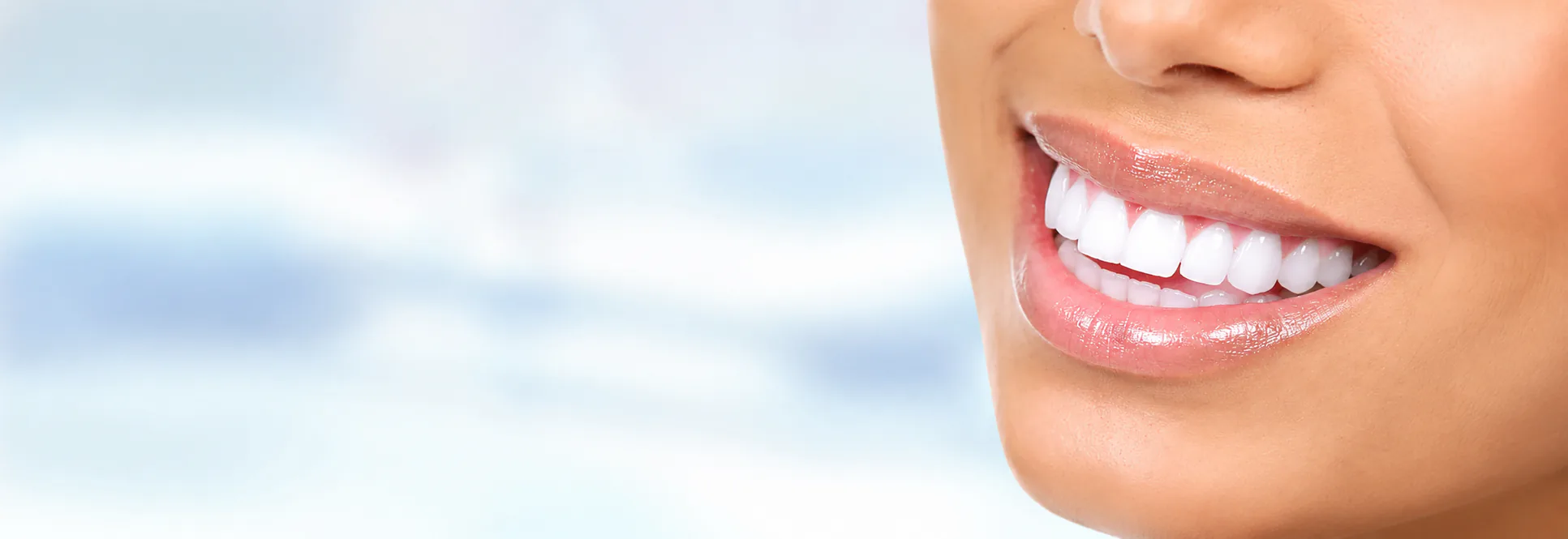 Teeth Whitening